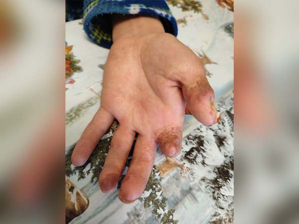 An Abused Child’s Journey Toward Healing 2